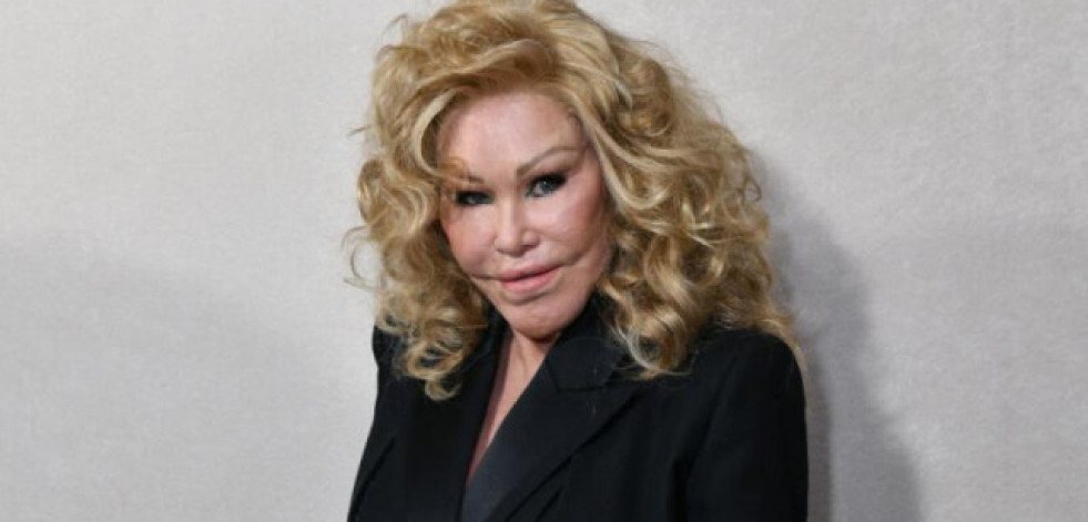 Fallece Jocelyn Wildenstein, famosa por sus extremas cirugías y conocida como 'Catwoman'